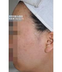 전후사진