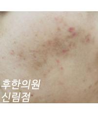 전후사진
