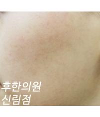 전후사진