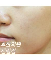 전후사진
