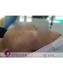 전후사진