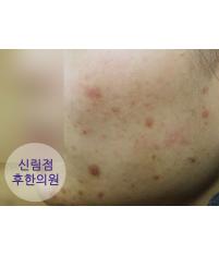전후사진