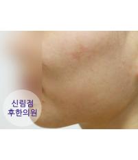 전후사진