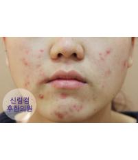 전후사진