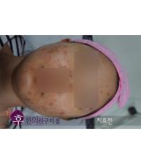 전후사진
