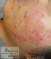 전후사진