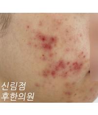전후사진