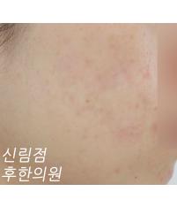 전후사진