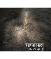 전후사진