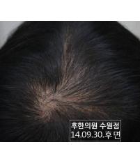 전후사진
