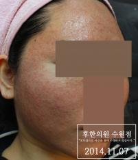 전후사진