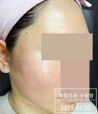 전후사진