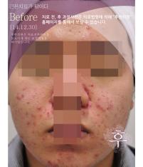 전후사진