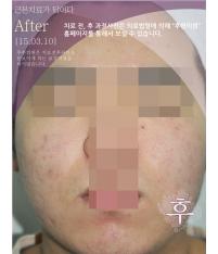 전후사진