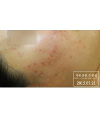 전후사진