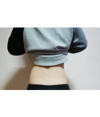 전후사진
