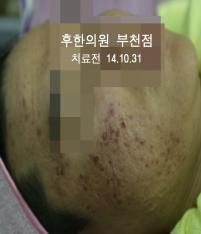 전후사진
