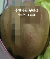 전후사진