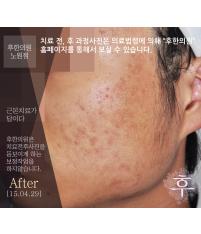 전후사진