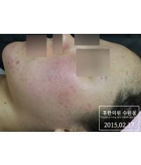 전후사진