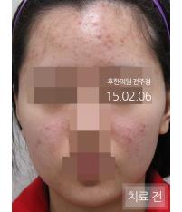 전후사진