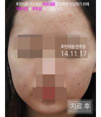전후사진