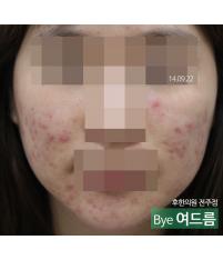 전후사진