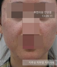 전후사진