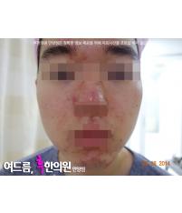전후사진