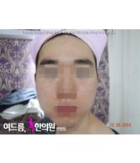 전후사진