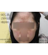 전후사진