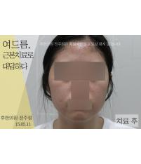 전후사진
