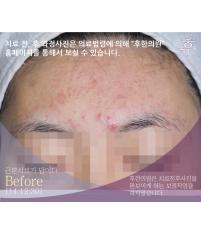 전후사진