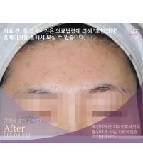 전후사진