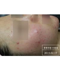 전후사진