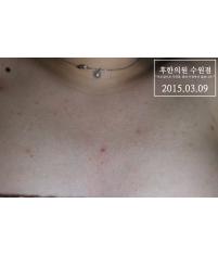 전후사진