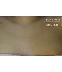 전후사진