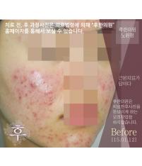 전후사진