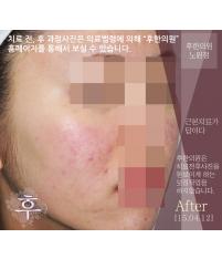 전후사진
