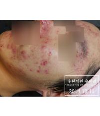전후사진