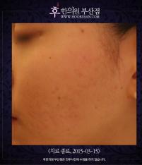 전후사진