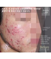 전후사진