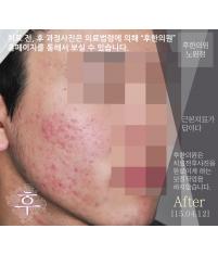 전후사진
