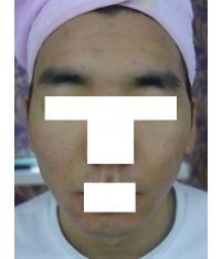 전후사진