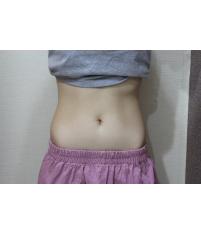 치료 후