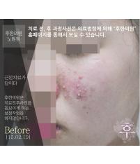 전후사진