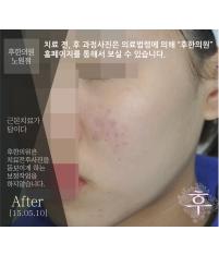전후사진