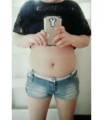 전후사진