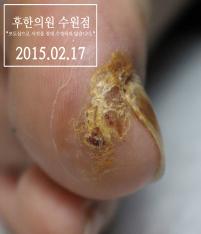 전후사진
