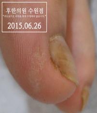 전후사진